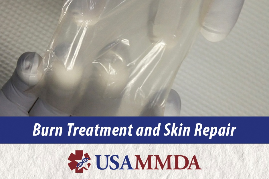 USAMMDA’s Burn Treatment Innovators Continue Future Treatment Developments, Modernization