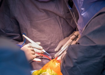 Robotic-Assisted Surgery Milestone at Belvoir Hospital