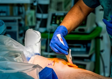 Robotic-Assisted Surgery Milestone at Belvoir Hospital