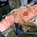 Army Medical Readiness Development in focus during Capability Days