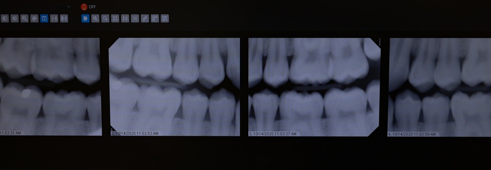 A day at the dentist