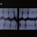 A day at the dentist