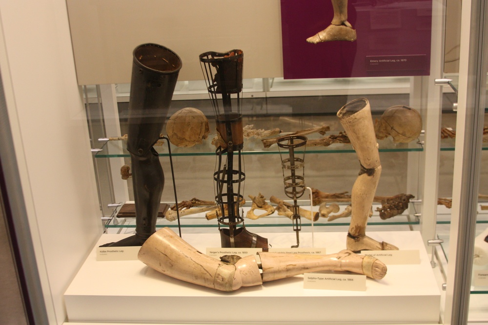 Advances in prostheses focus of medical museum’s Science Café