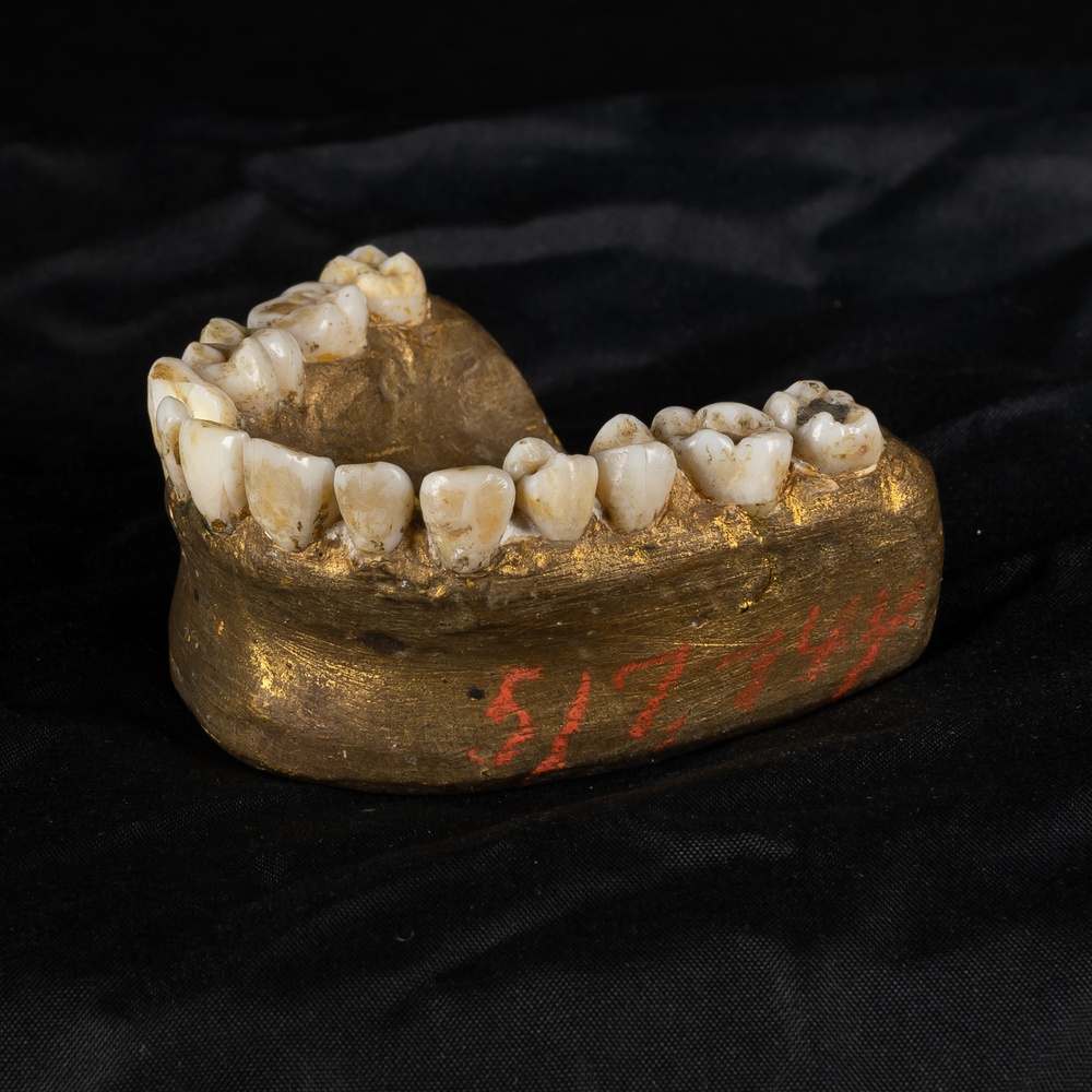 Mouth cast with human teeth