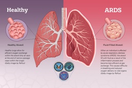 Respiratory Reinforcements