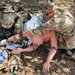 MEDCoE Best Medic