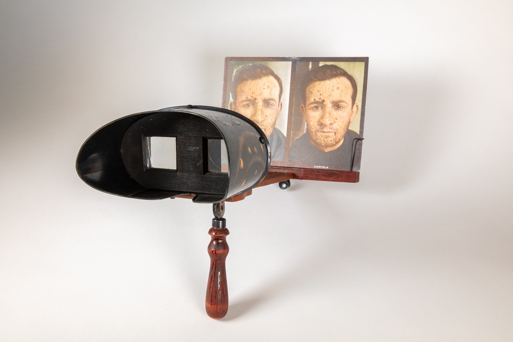 Stereoscope, with stereoscopic card, from The Stereoscopic Skin Clinic.’