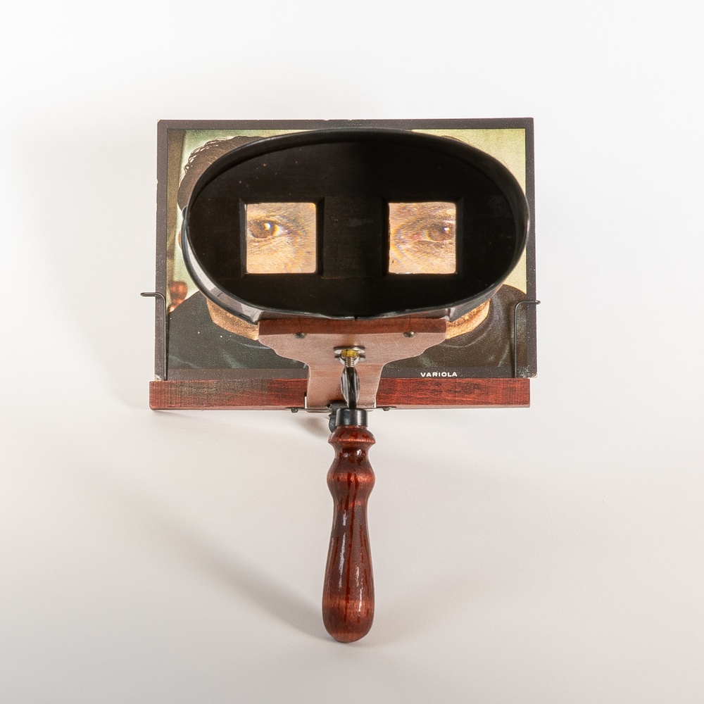 Stereoscope, with stereoscopic card, from The Stereoscopic Skin Clinic.’