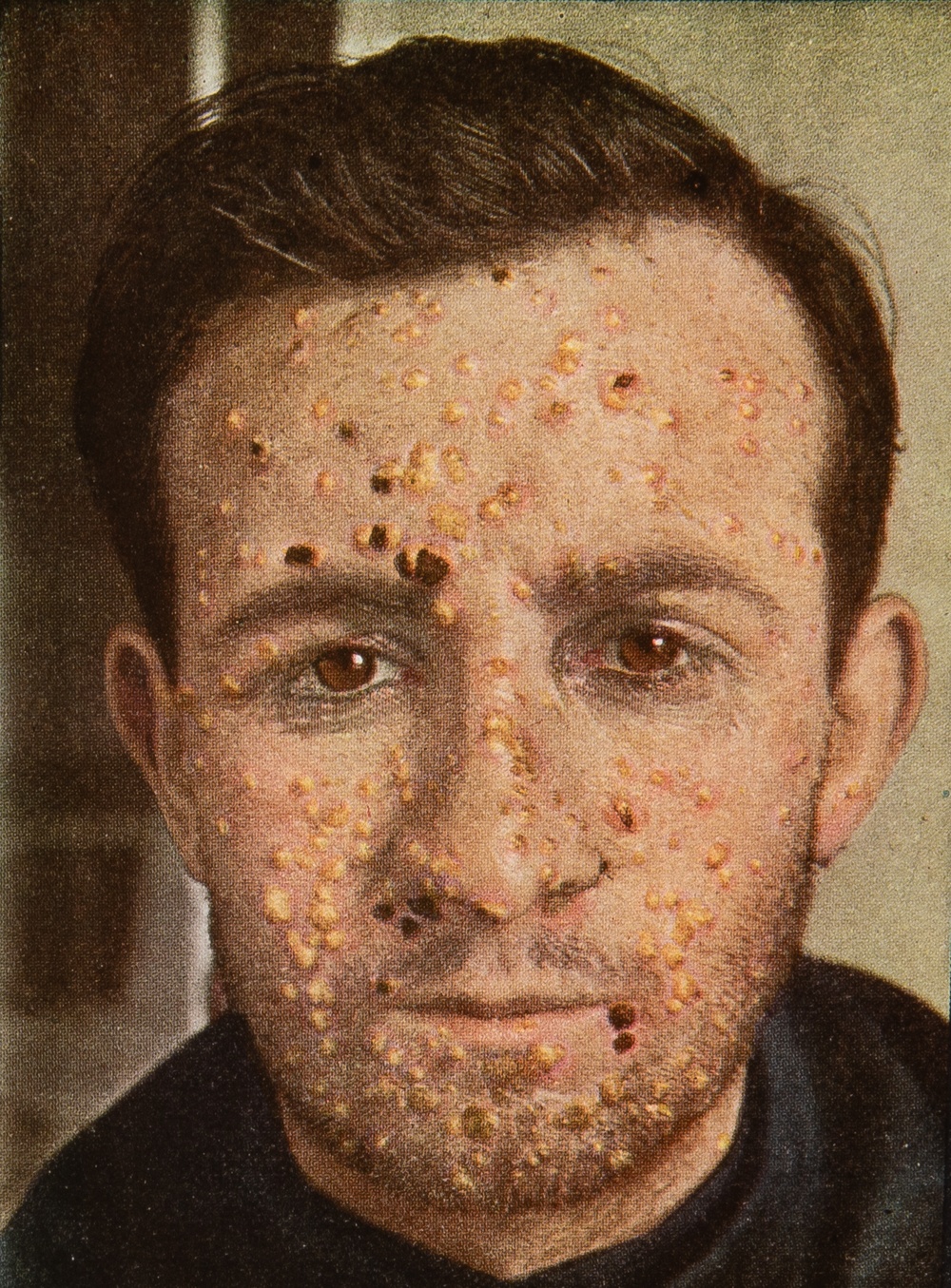 Stereoscopic card from The ‘Stereoscopic Skin Clinic.’.