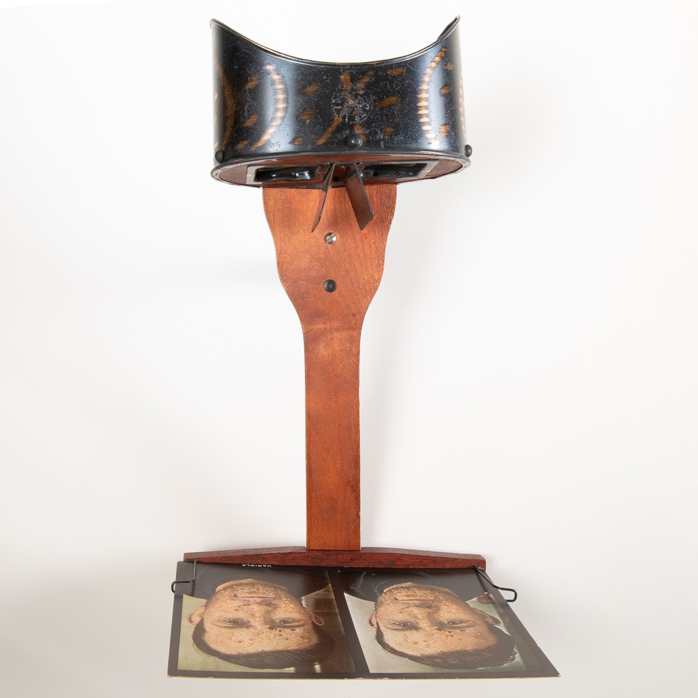 Stereoscope, with stereoscopic card, from The Stereoscopic Skin Clinic.’