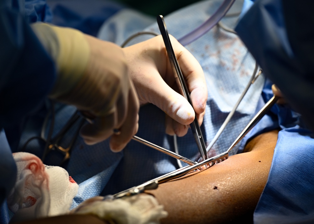Saint Lucia surgeries commence