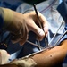 Saint Lucia surgeries commence