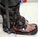 Spray Foam Cast Developed by USAMRDC Adopted for Rehabilitation Exoskeleton