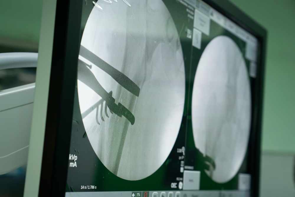 Surgical team perform bone surgery during LAMAT 24 medical assistance mission