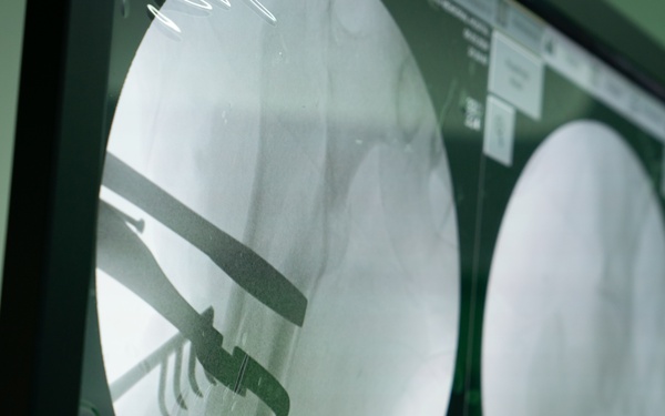 Surgical team perform bone surgery during LAMAT 24 medical assistance mission