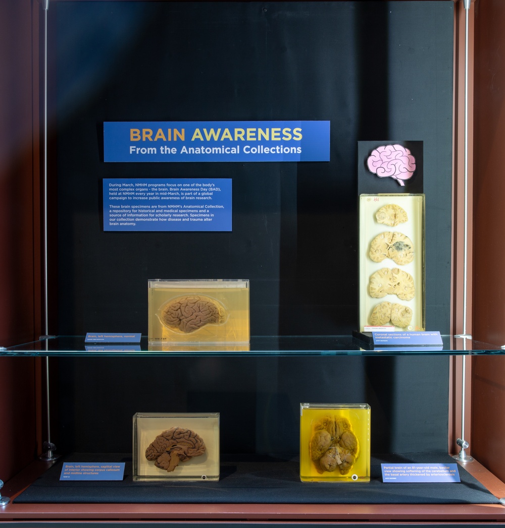 2024 Brain Awareness Exhibit
