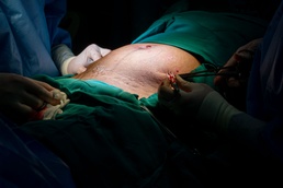 OBGYN surgeries key to humanitarian assistance during RS24