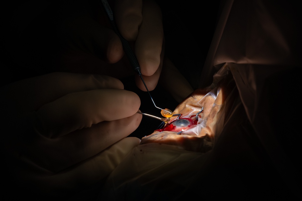 346th EOMRS Ophthalmologists conduct cataract surgery for 30 patients during RS24
