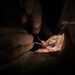 346th EOMRS Ophthalmologists conduct cataract surgery for 30 patients during RS24