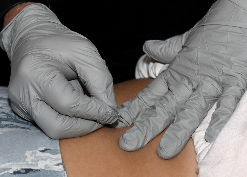 Fort Drum MEDDAC hosts DHA Dry Needling pain management course