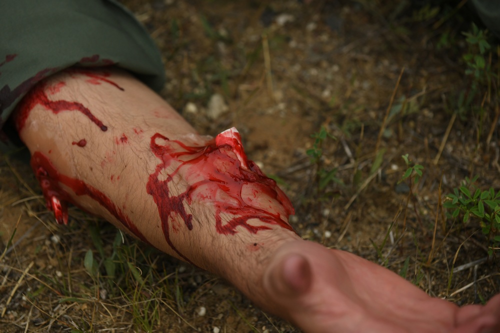 Mass causality training at Exercise Northern Strike