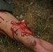 Mass causality training at Exercise Northern Strike