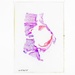 Orthopedic Pathology Histology Slide