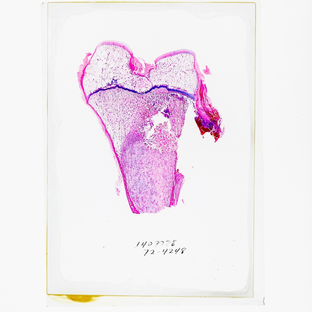 Orthopedic Pathology Histology Slide