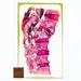 Orthopedic Pathology Histology Slide