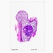 Orthopedic Pathology Histology Slide