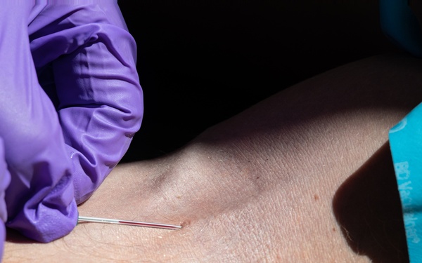 SY 24 | Valkyrie Blood Transfusion