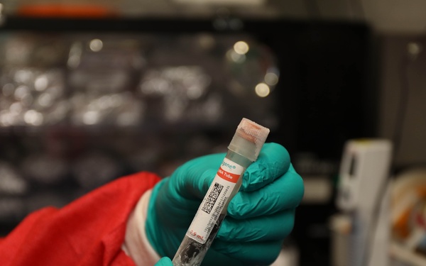 Technique for Early Detection of Sepsis in Burn Patients Submitted to FDA