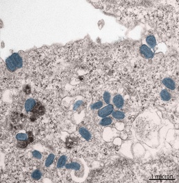 USAMRIID researchers contribute to the development of promising mpox vaccine