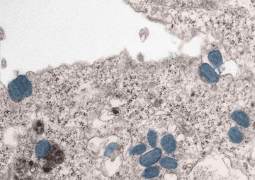 USAMRIID researchers contribute to the development of promising mpox vaccine