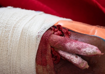 U.S. and Nepali collaboration takes flight during Pacific Angel 24-2