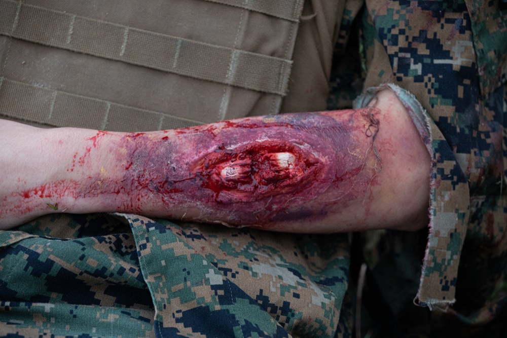 Shika-X 24: 3rd Dental Battalion Conducts Mass Casualty Simulation