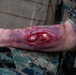 Shika-X 24: 3rd Dental Battalion Conducts Mass Casualty Simulation
