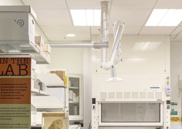 In The Lab: Kidney and Bladder Calculi Exhibit