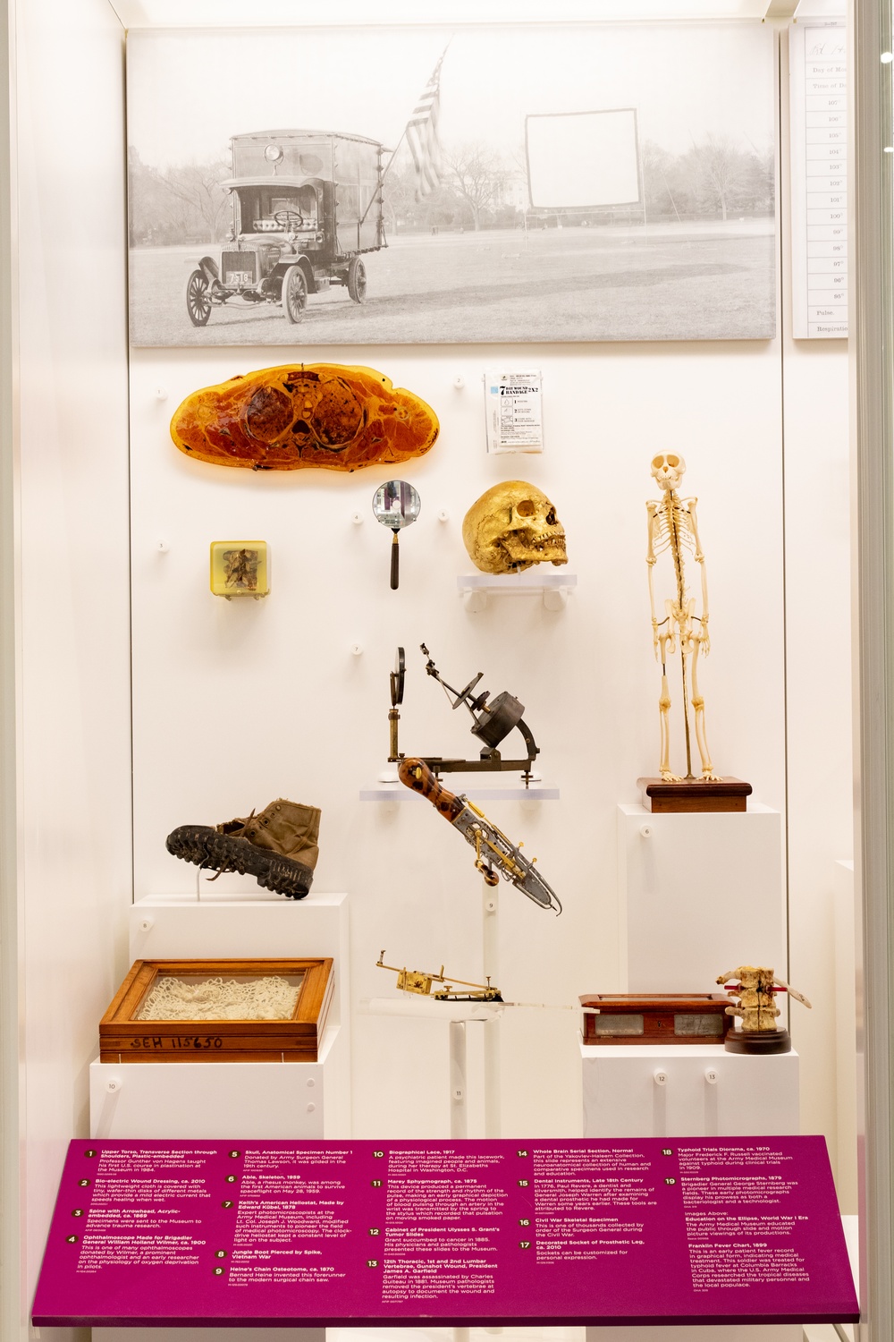 150 Years of the Army Medical Museum Exhibit