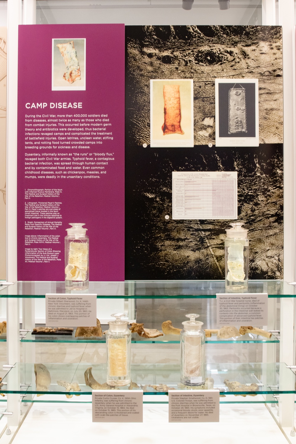 Camp Disease Exhibit