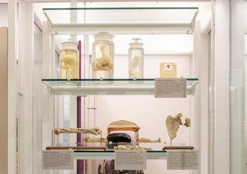 Bone Disease Exhibit