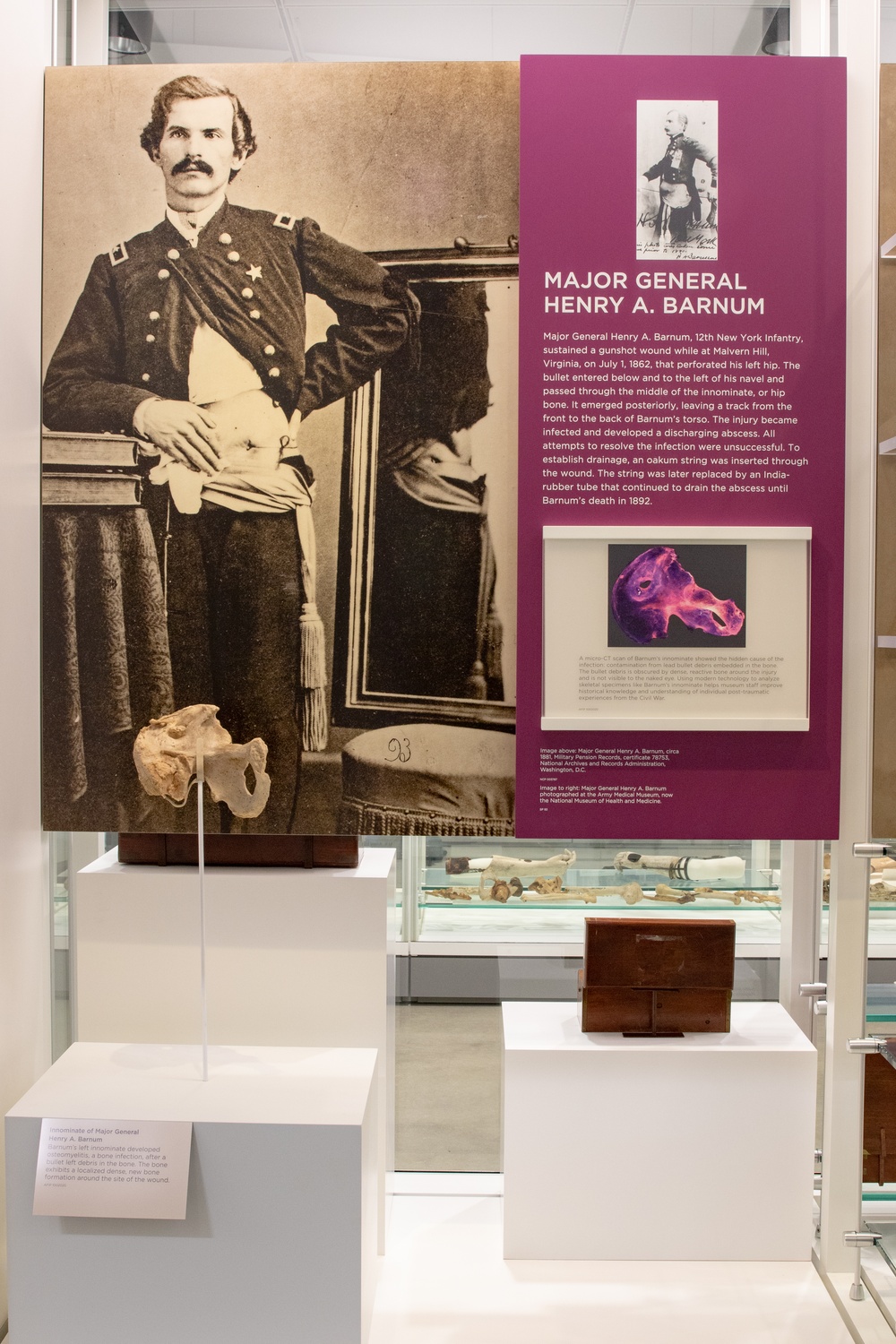 Major General Henry A. Barnum Exhibit