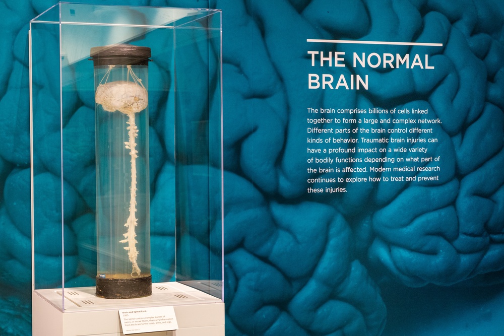 The Normal Brain