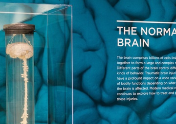 The Normal Brain