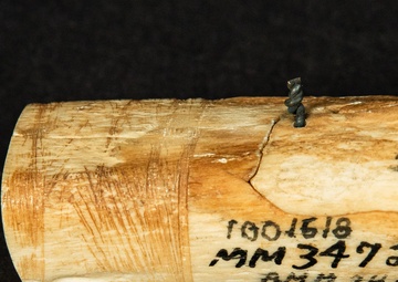 Civil War Gunshot Wound