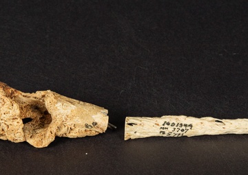 Civil War Gunshot Wound