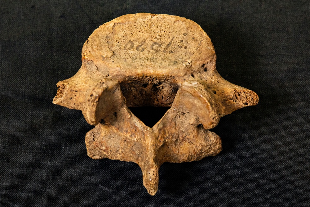 Lumbar Vertebra