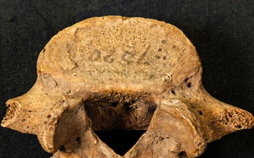 Lumbar Vertebra