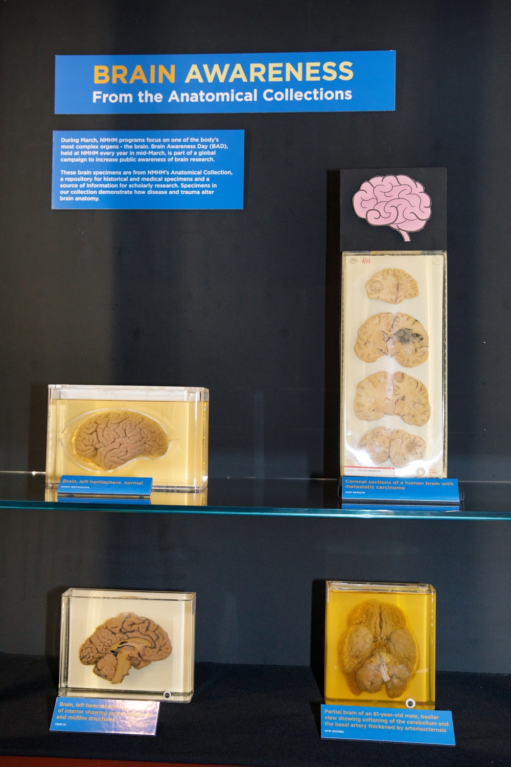 Brain Awareness From the Historical Collections