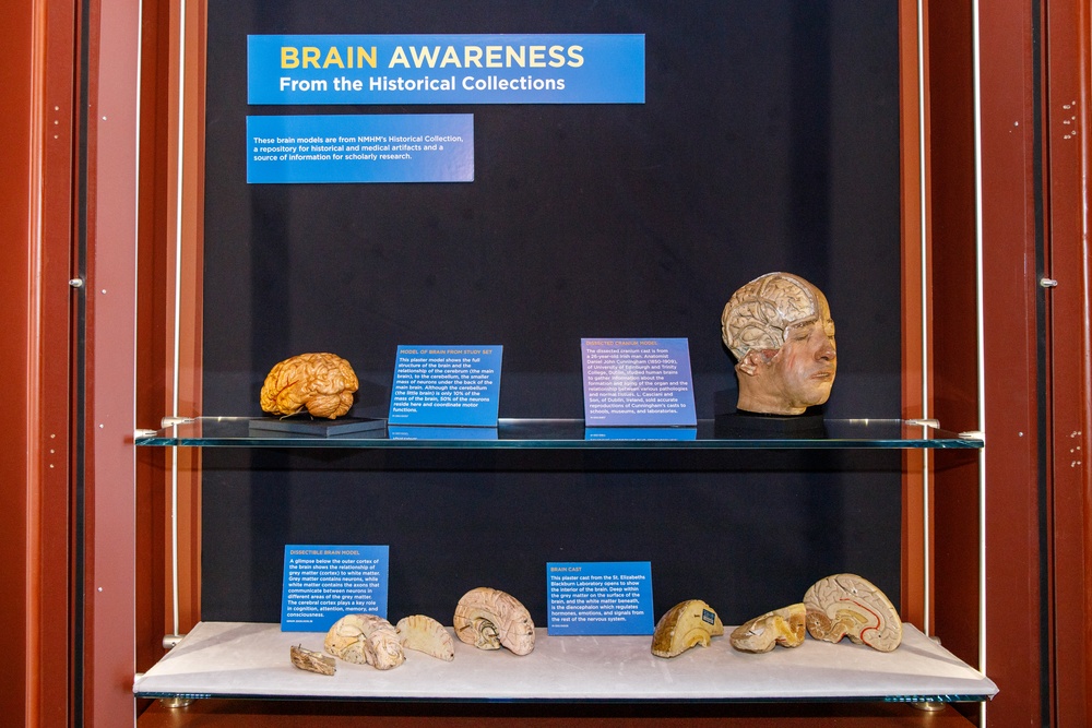 Brain Awareness From the Historical Collections